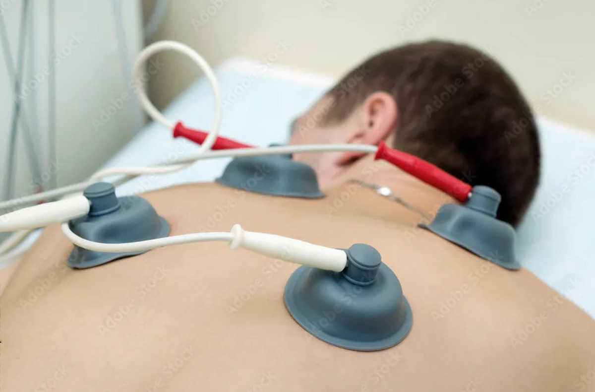 elektrotherapie physiotherapie
